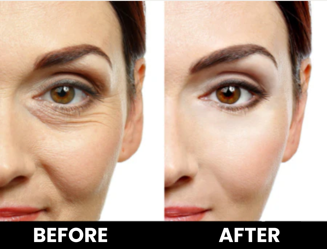 SkinFlex - Collagen Patches